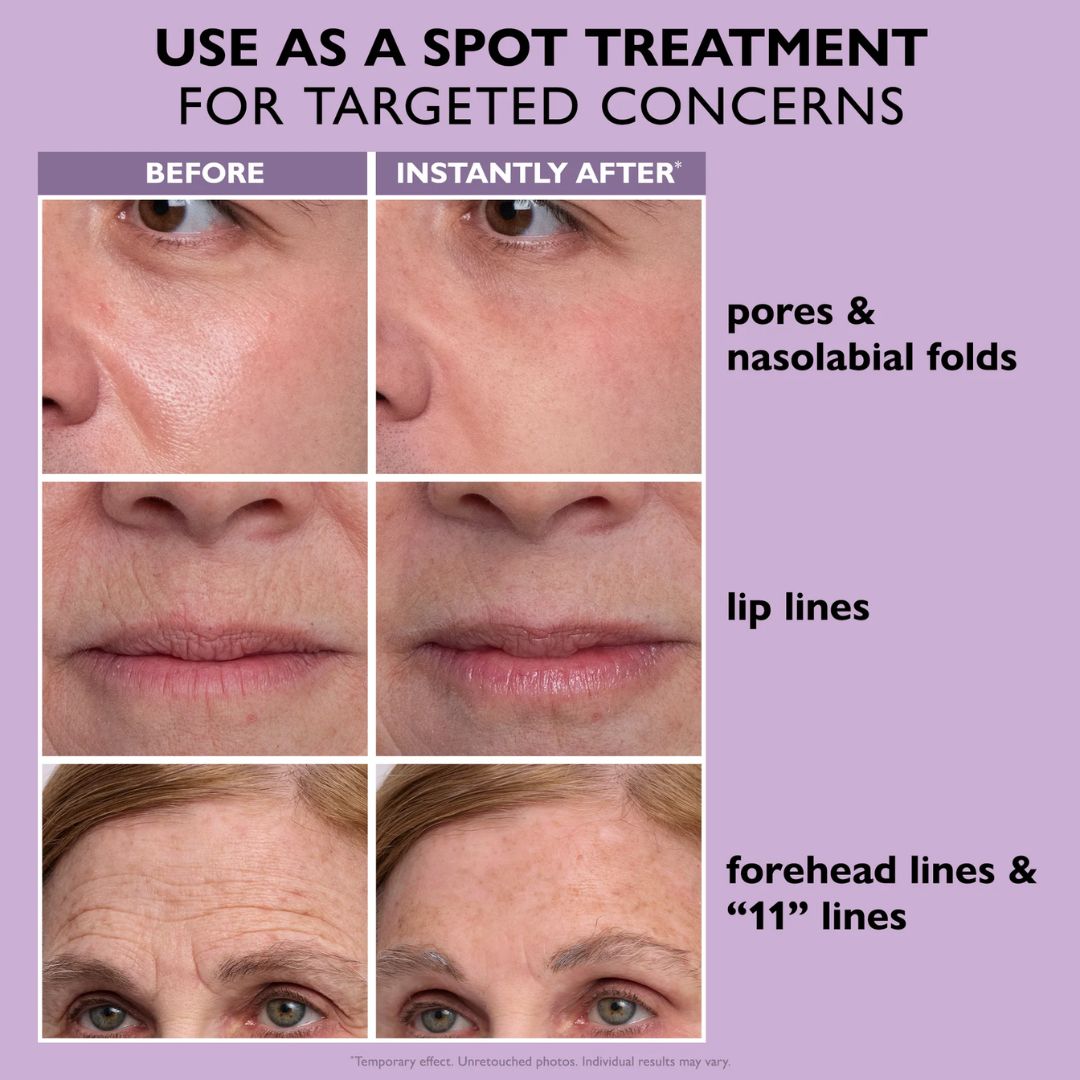 🔥Summer sale Instant Face Provisional Eye Tightener