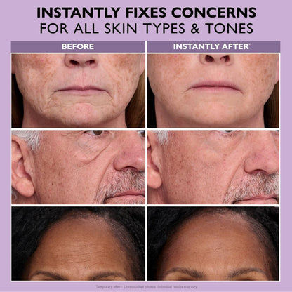 🔥Summer sale Instant Face Provisional Eye Tightener